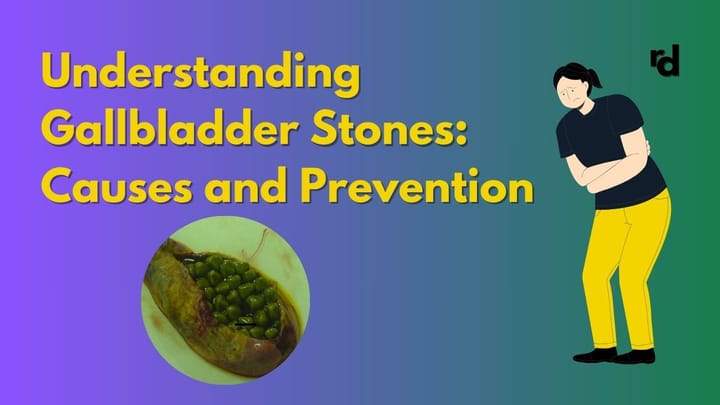 Understanding Gallbladder Stones: Causes and Prevention